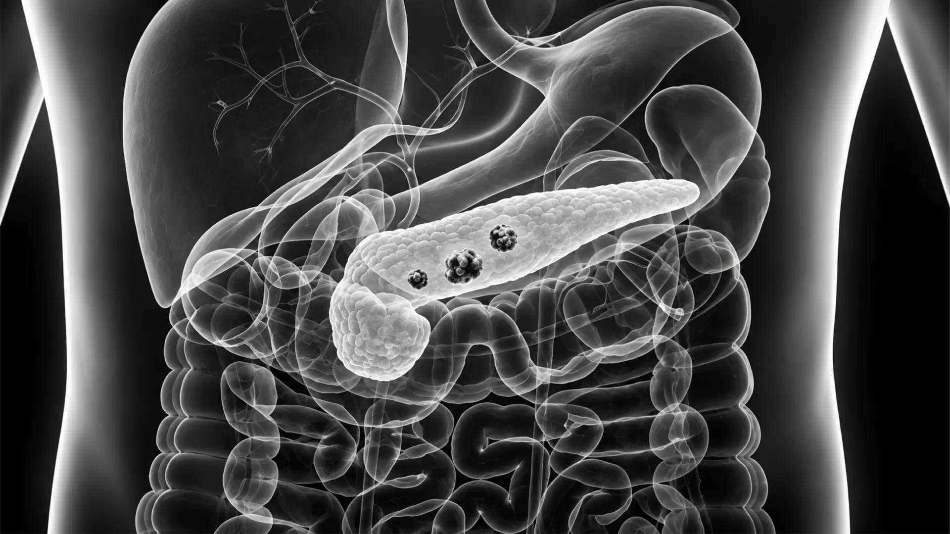 Radiographic illustration of the pancreas and surrounding organs